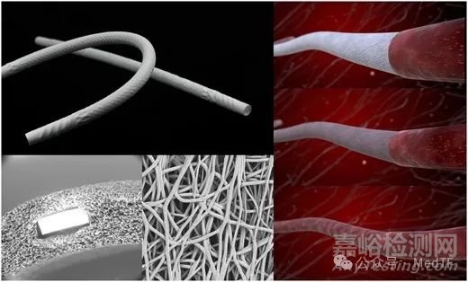 【創(chuàng)新醫(yī)械】XABG：用于冠狀動(dòng)脈搭橋手術(shù)的修復(fù)性人造血管