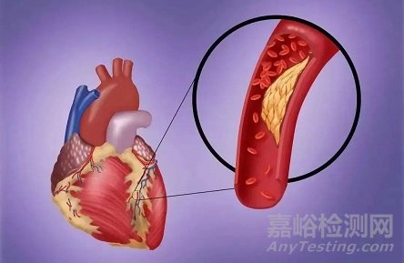國(guó)產(chǎn)首款可控彎微導(dǎo)管獲批上市