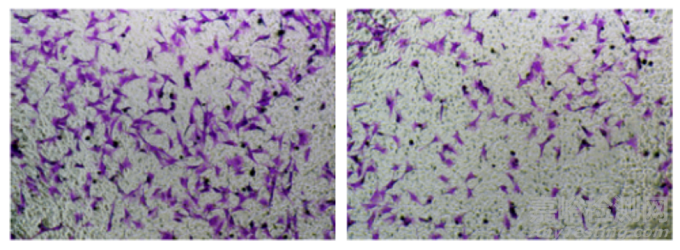 細(xì)胞遷移和侵襲實(shí)驗(yàn)步驟與注意事項(xiàng)