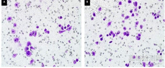 細(xì)胞遷移和侵襲實(shí)驗(yàn)步驟與注意事項(xiàng)
