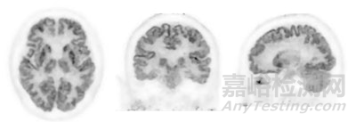 【創(chuàng)新醫(yī)械】島津研發(fā)的頭部和乳房高分辨率正電子發(fā)射斷層掃描PET系統(tǒng)獲批FDA