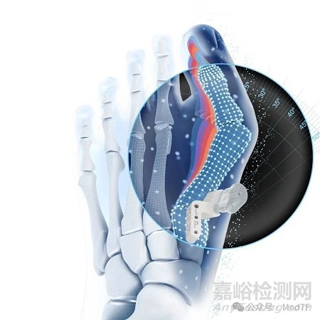 強生推出首款骨科AI產(chǎn)品