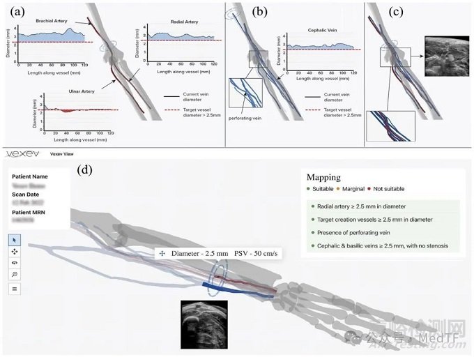 【創(chuàng)新醫(yī)械】VxWave：3D斷層掃描超聲機器人，自主掃描并形成分析報告