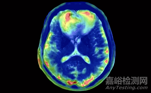 西門子醫(yī)療創(chuàng)新醫(yī)械磁共振成像系統(tǒng)技術(shù)解析