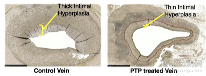 PTP：光引發(fā)交聯(lián)劑，讓靜脈動(dòng)脈化