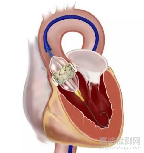 以心醫(yī)療創(chuàng)新醫(yī)械經(jīng)導(dǎo)管主動脈瓣系統(tǒng)技術(shù)解析