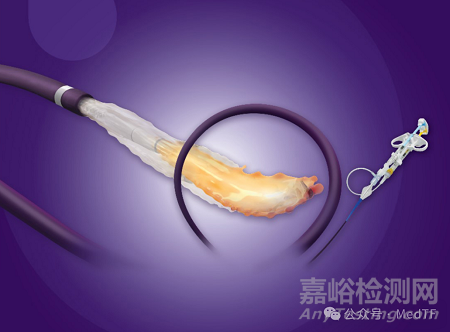 Embrace HES:水凝膠血管栓塞劑獲FDA批準(zhǔn)