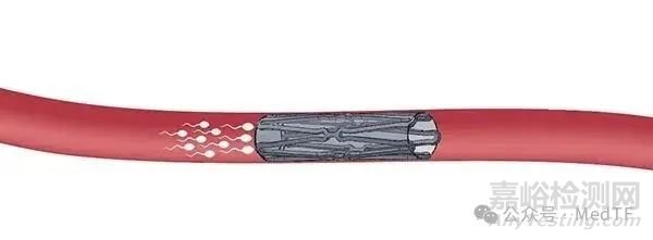 【創(chuàng)新醫(yī)械】Proventis：長效可靠且可逆的男性避孕支架