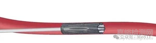 【創(chuàng)新醫(yī)械】Proventis：長效可靠且可逆的男性避孕支架