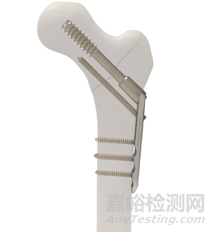 【創(chuàng)新醫(yī)械】模塊化設(shè)計(jì)的3P小兒髖部植入系統(tǒng)技術(shù)解析