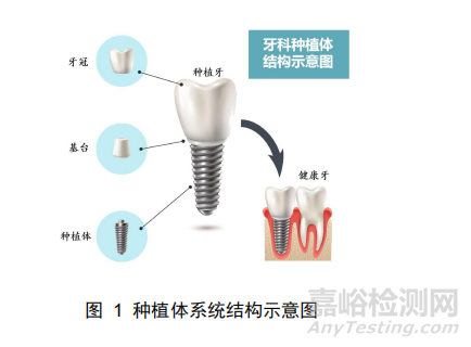 《牙科種植體系統(tǒng)生產(chǎn)環(huán)節(jié)風(fēng)險清單和檢查指南》