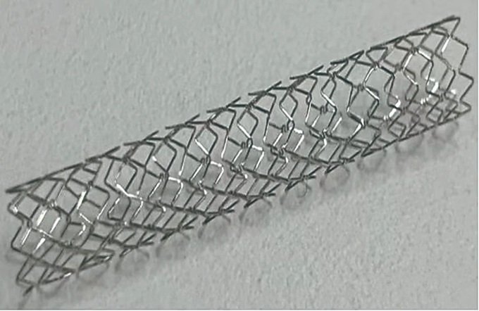 全球首款高氮無鎳心血管支架獲批，告別鎳過敏風險