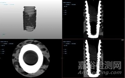 牙科種植體臨床前動物試驗研究常見問題