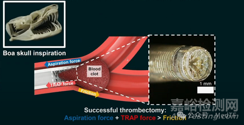【創(chuàng)新醫(yī)械】TRAP：帶“牙齒”的抽吸導(dǎo)管，取栓成功率提高300%