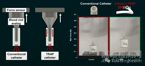 【創(chuàng)新醫(yī)械】TRAP：帶“牙齒”的抽吸導(dǎo)管，取栓成功率提高300%