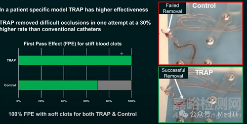 【創(chuàng)新醫(yī)械】TRAP：帶“牙齒”的抽吸導(dǎo)管，取栓成功率提高300%
