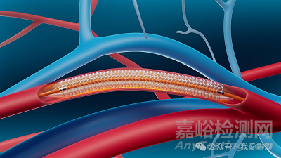 雅培依維莫司洗脫可吸收支架獲批CE，治療膝下外周動(dòng)脈疾病