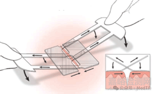 【創(chuàng)新醫(yī)械】Clozex：能縫合傷口的膠帶，無需縫線