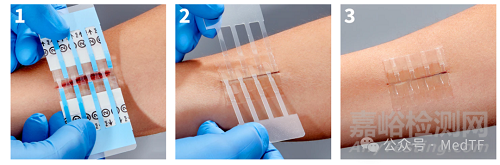 【創(chuàng)新醫(yī)械】Clozex：能縫合傷口的膠帶，無需縫線