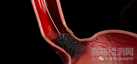 【創(chuàng)新醫(yī)械】EndoSign:食管癌檢測膠囊
