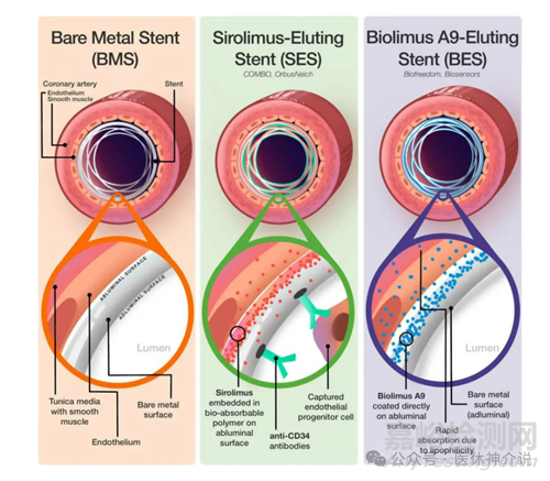 藥物洗脫支架：材料、涂層及7種藥物選擇
