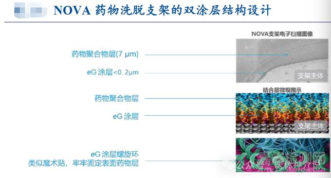 藥物洗脫支架：材料、涂層及7種藥物選擇