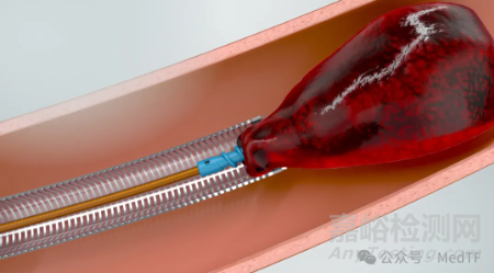 FDA批準首款大口徑連續(xù)真空抽吸導管，治療肺栓塞