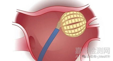 全球唯一集成高密度標測的PFA消融導管獲批FDA