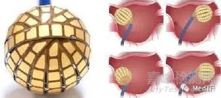 全球唯一集成高密度標測的PFA消融導管獲批FDA