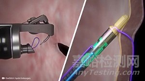 全球自動(dòng)化縫合設(shè)備技術(shù)、產(chǎn)品與市場分析