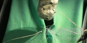 全球自動(dòng)化縫合設(shè)備技術(shù)、產(chǎn)品與市場分析