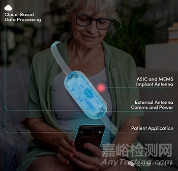 【創(chuàng)新醫(yī)械】V-LAP：全球首臺(tái)微型、無(wú)線、無(wú)電池心內(nèi)微型計(jì)算機(jī)