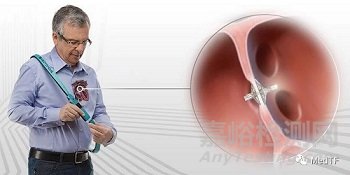 【創(chuàng)新醫(yī)械】V-LAP：全球首臺(tái)微型、無(wú)線、無(wú)電池心內(nèi)微型計(jì)算機(jī)