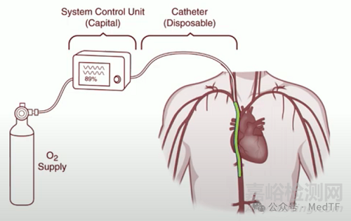 【創(chuàng)新醫(yī)械】VQ Catheter：血管內(nèi)氧合導管，血管內(nèi)氣體交換的ECMO