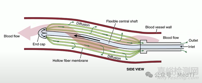 【創(chuàng)新醫(yī)械】VQ Catheter：血管內(nèi)氧合導管，血管內(nèi)氣體交換的ECMO