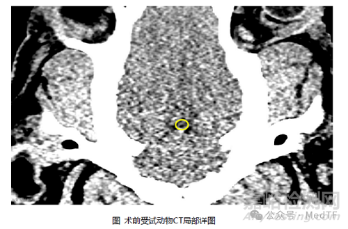 國(guó)產(chǎn)首家全自研腦外科電磁導(dǎo)航系統(tǒng)