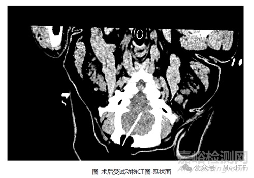 國(guó)產(chǎn)首家全自研腦外科電磁導(dǎo)航系統(tǒng)