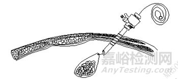 剛剛，《一次性使用內(nèi)窺鏡用活檢袋注冊審查 指導(dǎo)原則》正式發(fā)布（附全文）