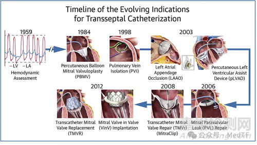 國(guó)內(nèi)首款新型射頻房間隔穿刺系統(tǒng)正式上市