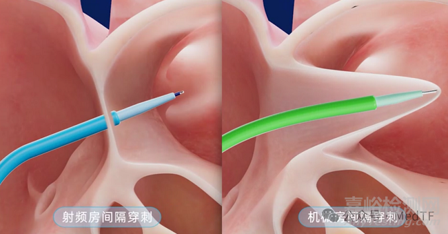 國(guó)內(nèi)首款新型射頻房間隔穿刺系統(tǒng)正式上市