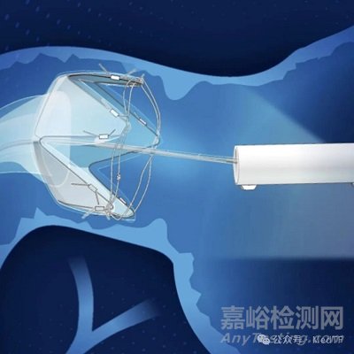 【創(chuàng)新醫(yī)械】RESET胃轉(zhuǎn)流支架，平均減重近18.9%，1298名真實(shí)世界研究