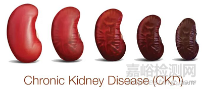 Moda-flx：家用血透透析機(jī)完成首例臨床入組