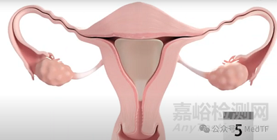 Womed Leaf：FDA批準(zhǔn)首款解決宮腔粘連的可降解薄膜