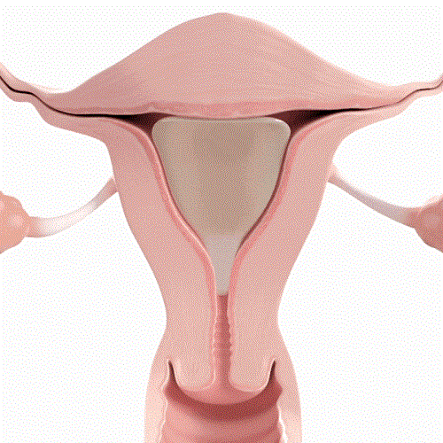 Womed Leaf：FDA批準(zhǔn)首款解決宮腔粘連的可降解薄膜