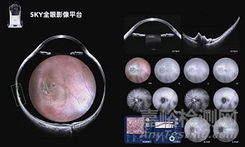 國產(chǎn)首款全眼影像平臺獲批CE