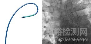 不同醫(yī)療介入導管的顯影需求與標記設計選擇