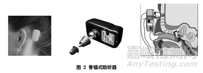 骨導(dǎo)助聽器的醫(yī)械分類、標準與注冊要點