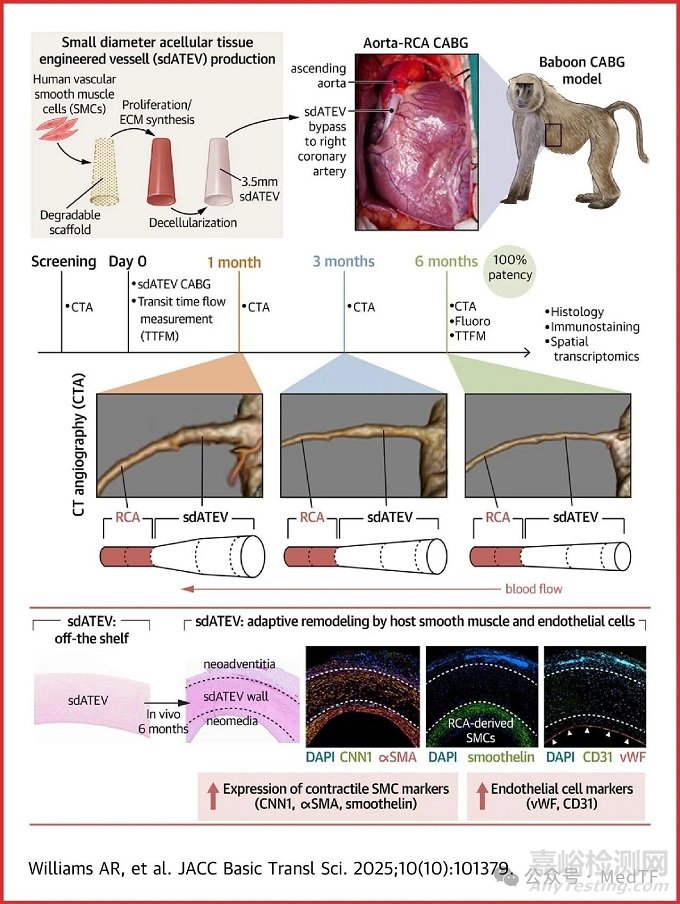 CTEV:全球最細(xì)冠脈搭橋人工血管,臨床研究顯示術(shù)后保持通暢