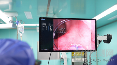 【創(chuàng)新醫(yī)械】AQ-400：首款3D超高清軟鏡系統(tǒng)獲批上市