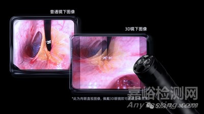 【創(chuàng)新醫(yī)械】AQ-400：首款3D超高清軟鏡系統(tǒng)獲批上市
